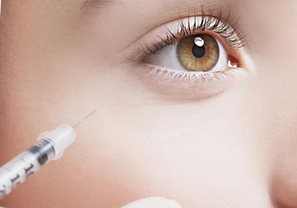 Removing dimples and dark circles under the eyes with filler injections